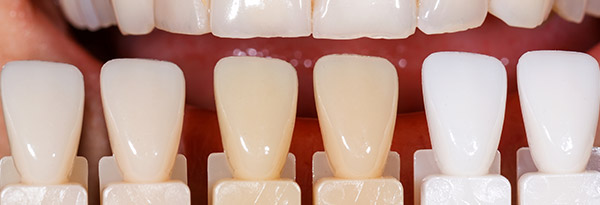 Ferro offers the highest purity dental pigments 